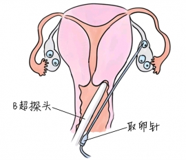幼儿学画画，惠州捐卵宝宝学画画，学画画的好处，如何学画画