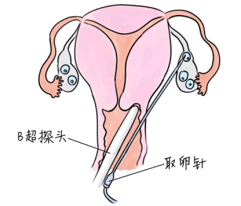 幼儿学画画，惠州捐卵宝宝学画画，学画画的好处，如何学画画